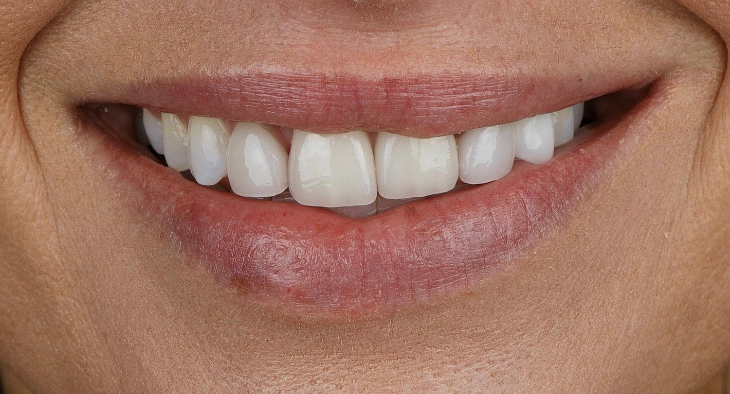 Patients Before & After