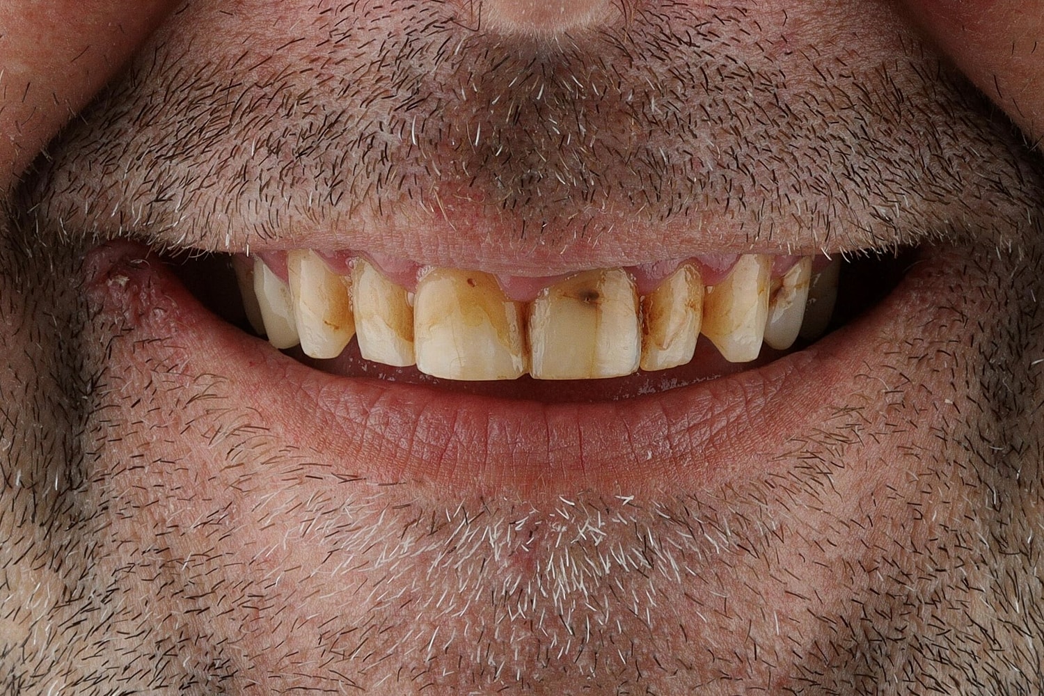 Patients Before & After