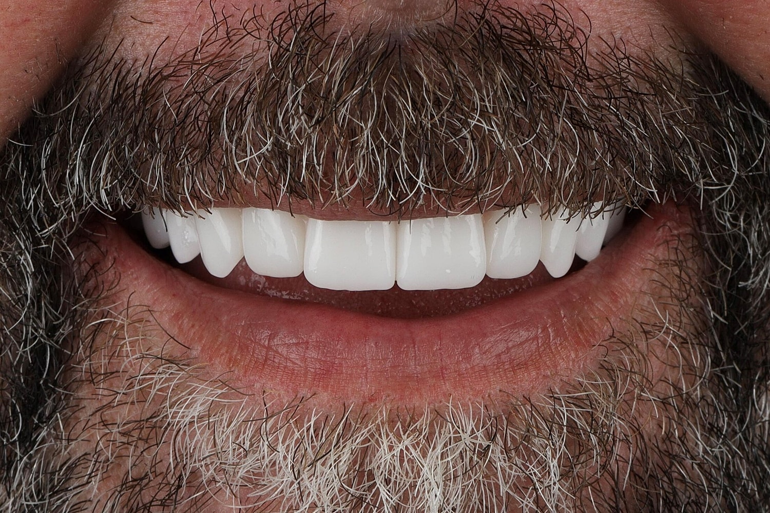 Patients Before & After