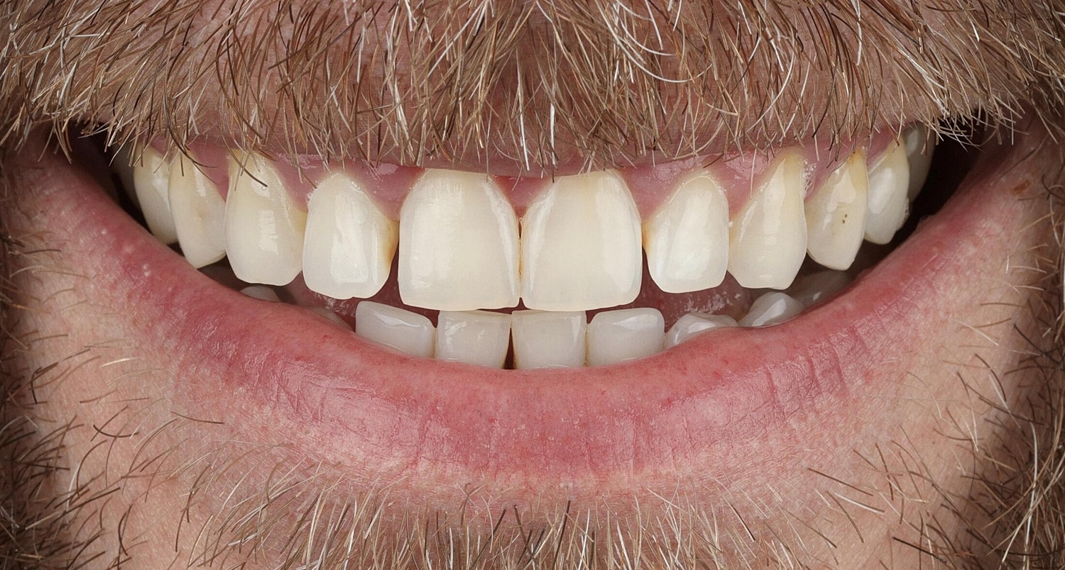 Patients Before & After