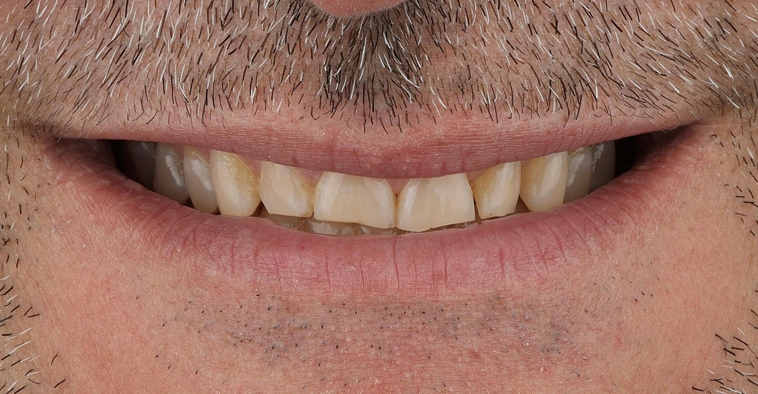 Patients Before & After