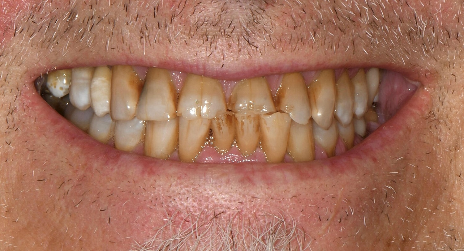 Patients Before & After