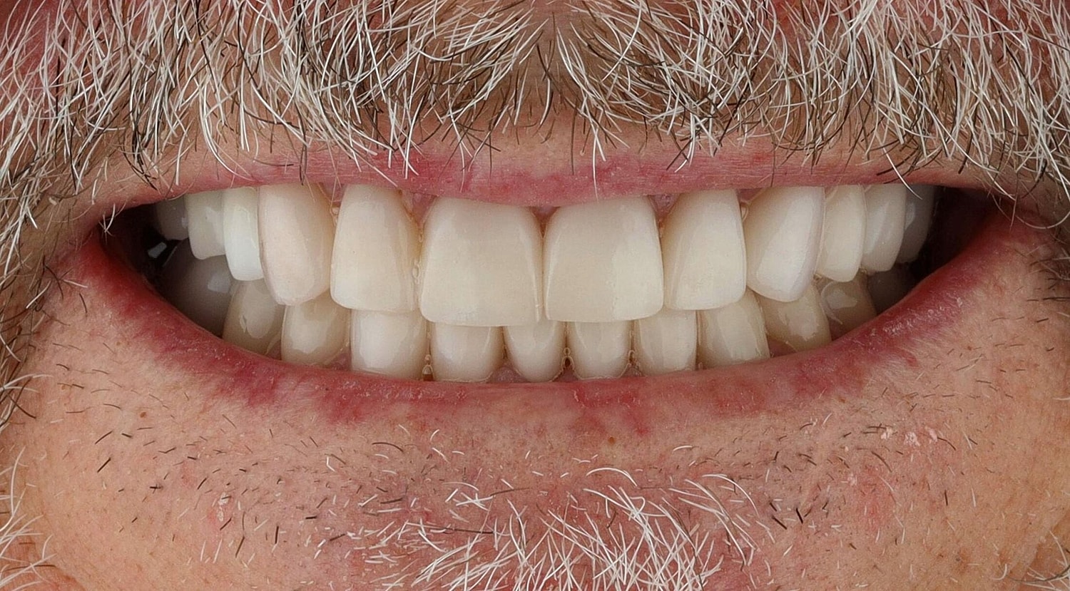 Patients Before & After