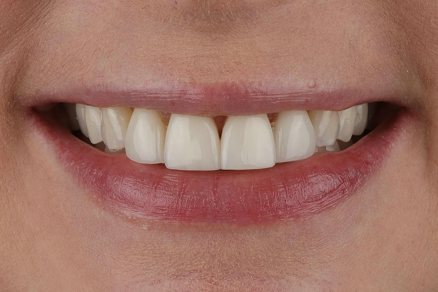 Patients Before & After