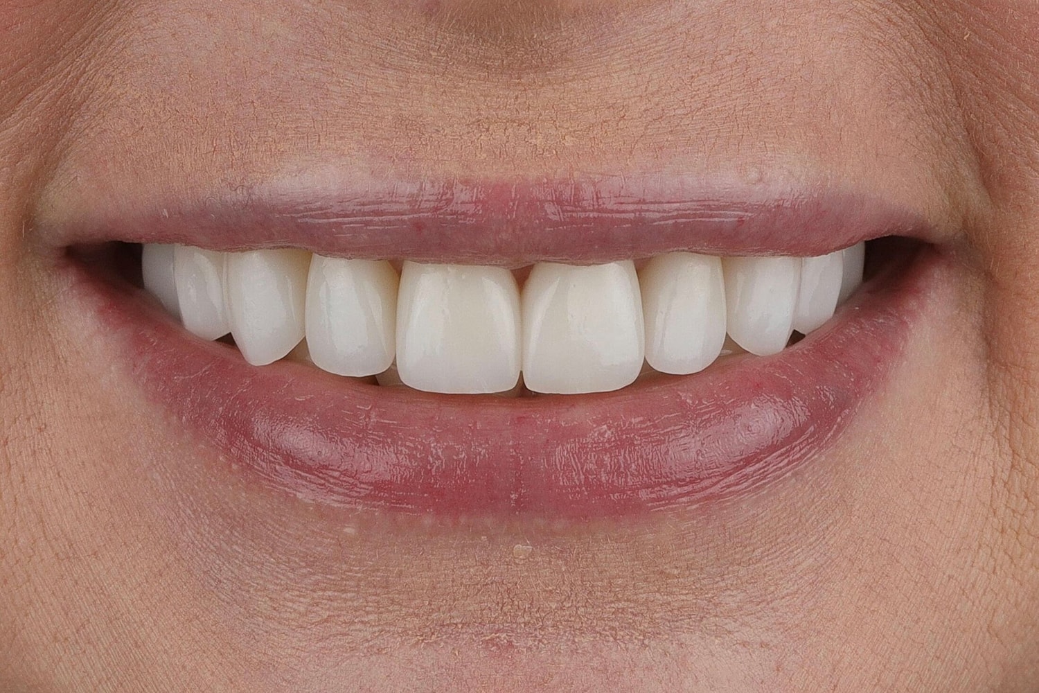 Patients Before & After