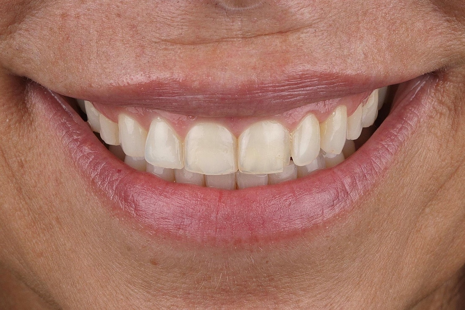 Close-up of smiling mouth with healthy teeth.