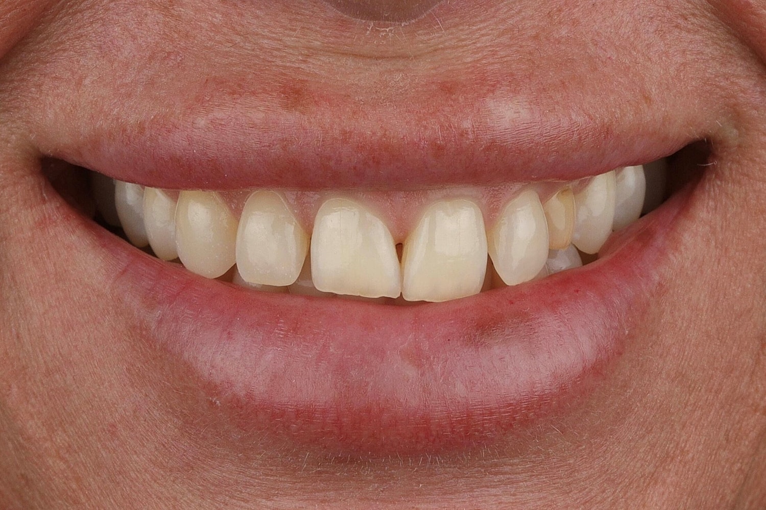 Patients Before & After