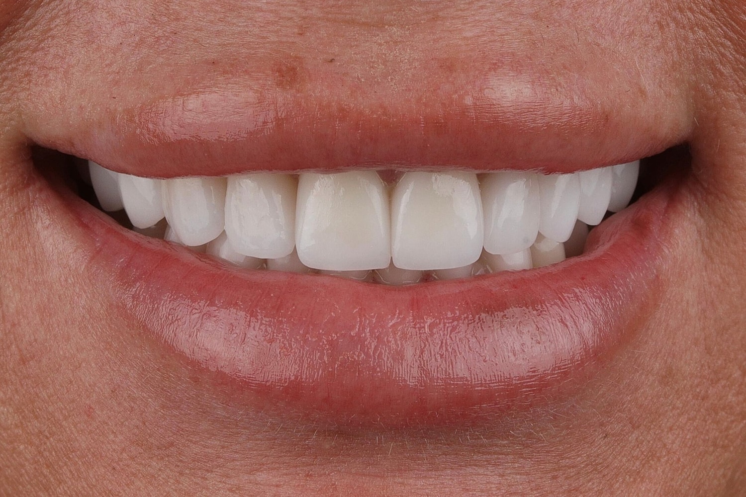 Patients Before & After