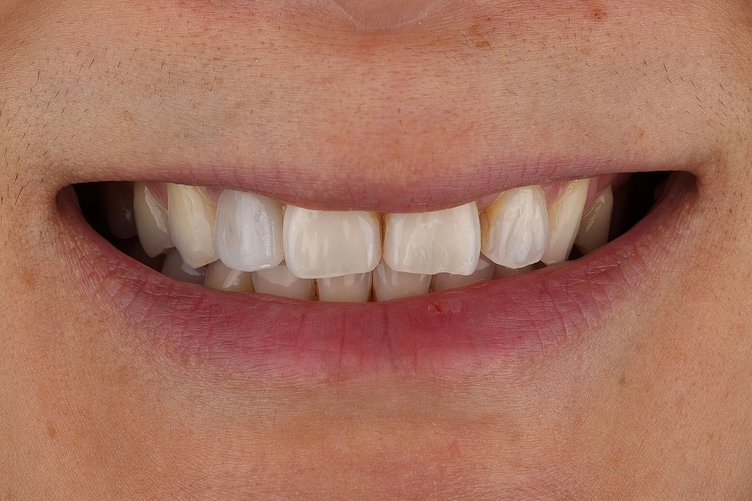 Patients Before & After