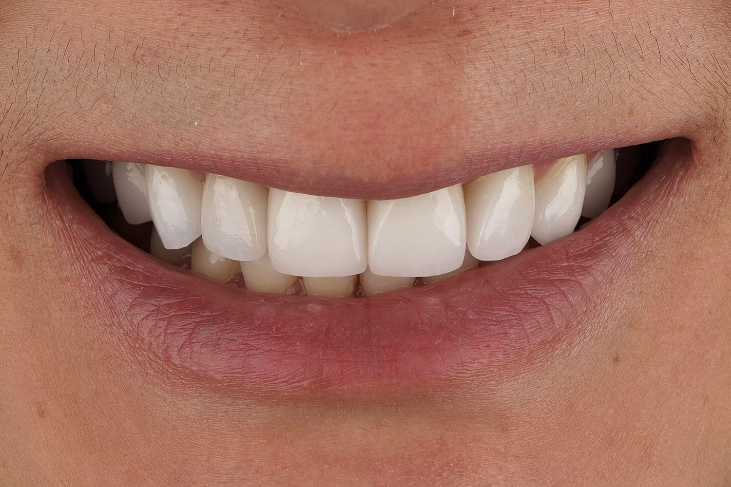 Patients Before & After
