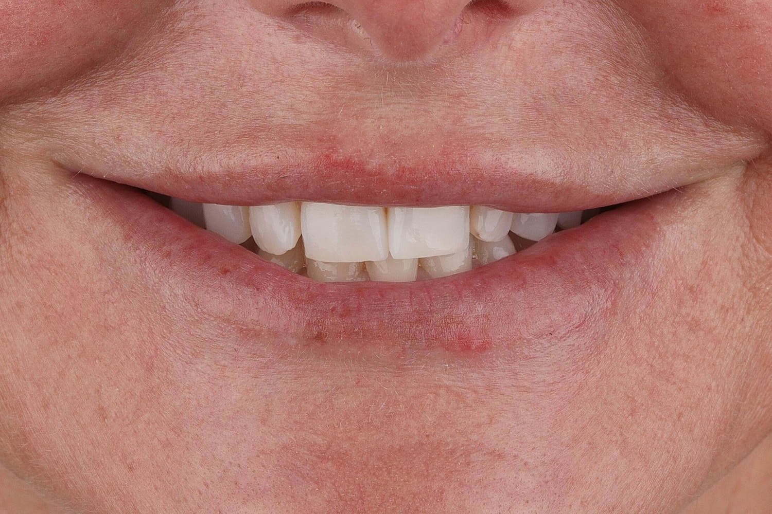 Patients Before & After