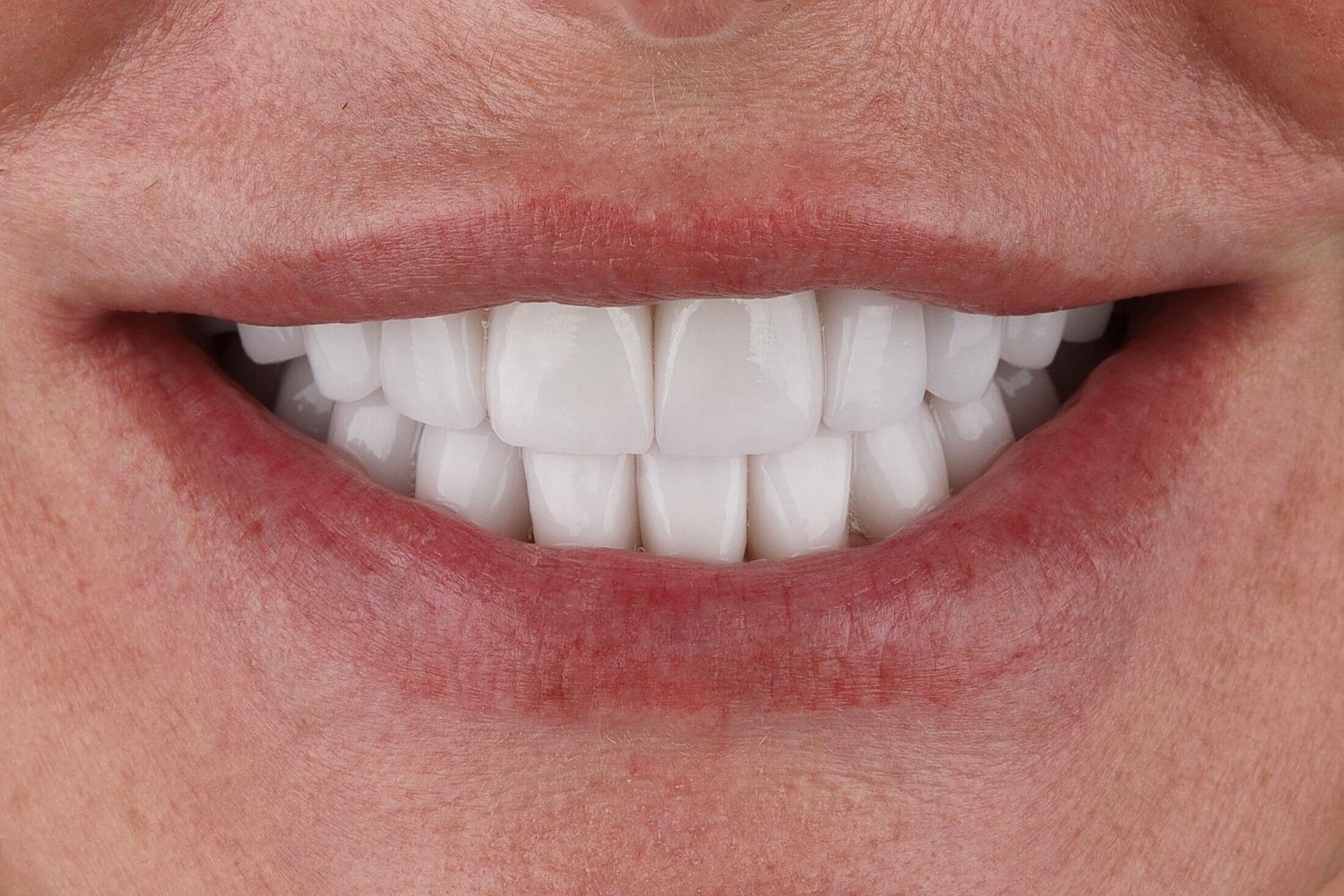 Patients Before & After
