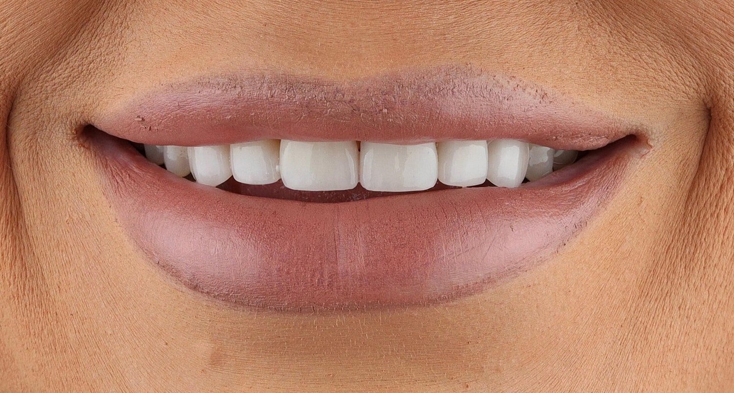 Patients Before & After