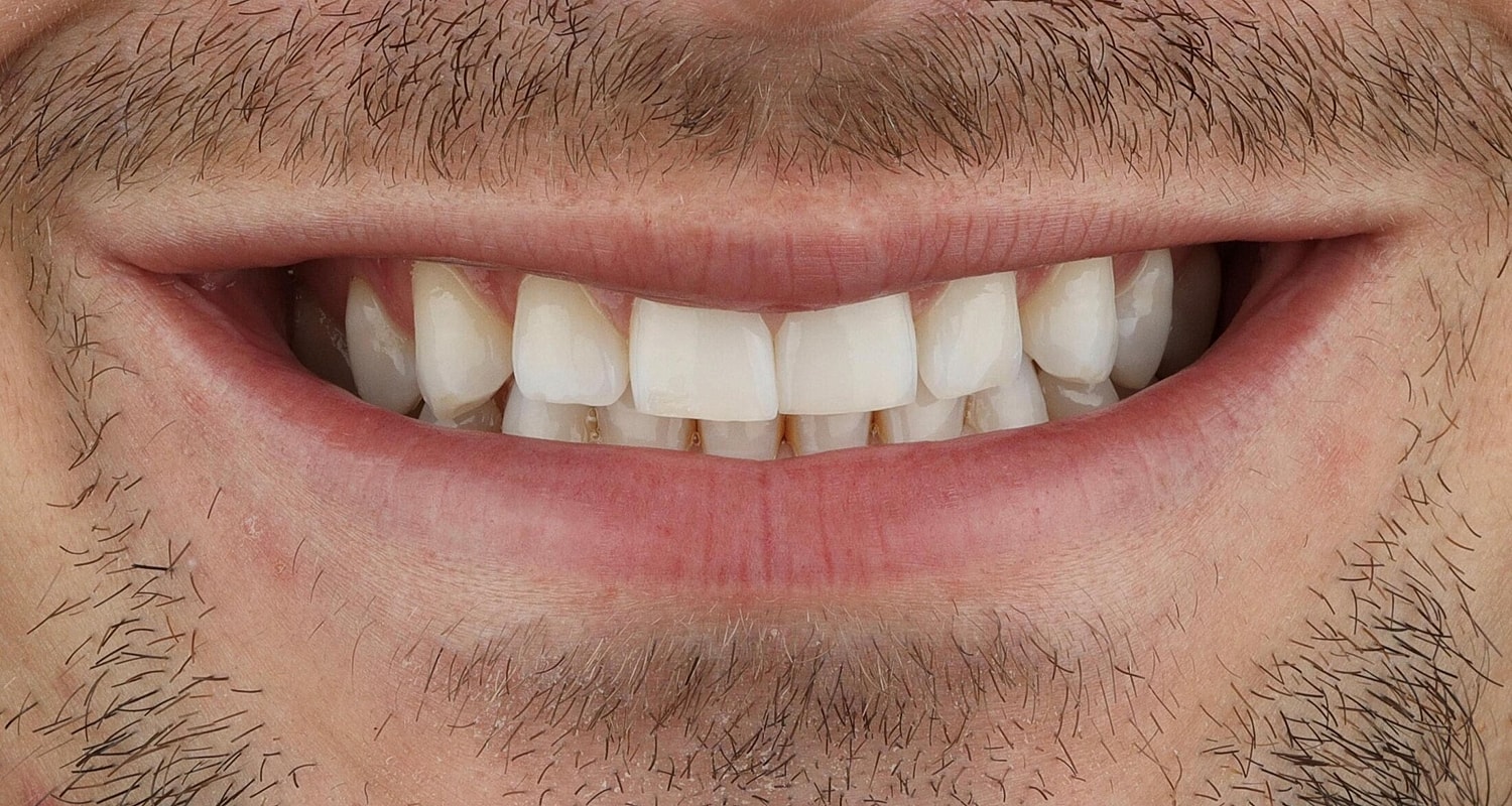 Patients Before & After