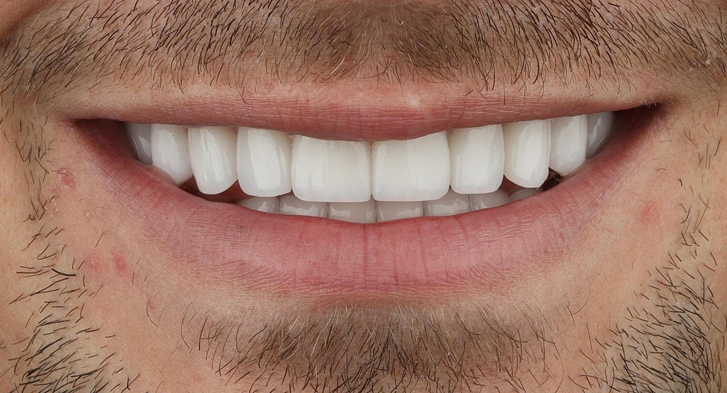 Patients Before & After