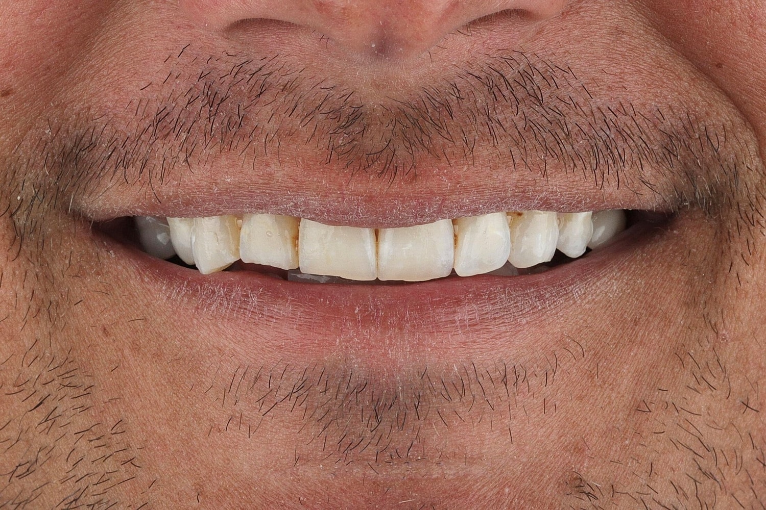 Patients Before & After