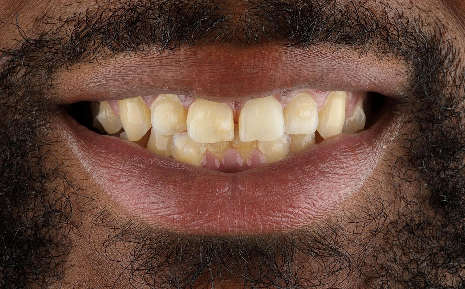Patients Before & After