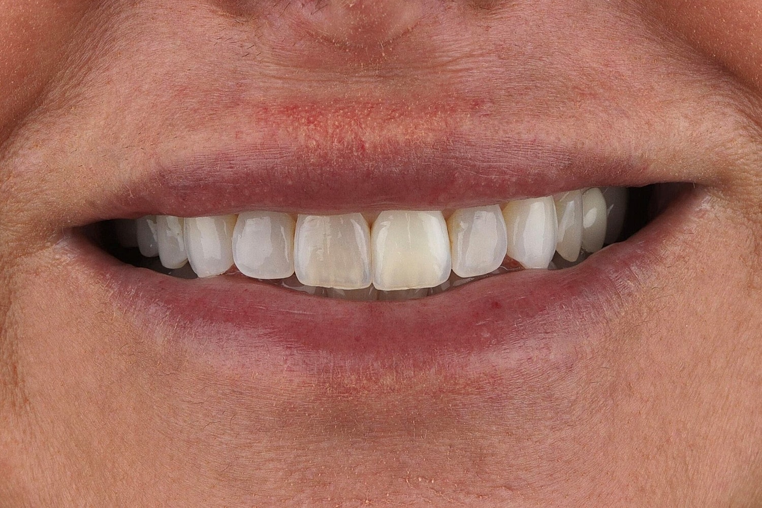 Patients Before & After