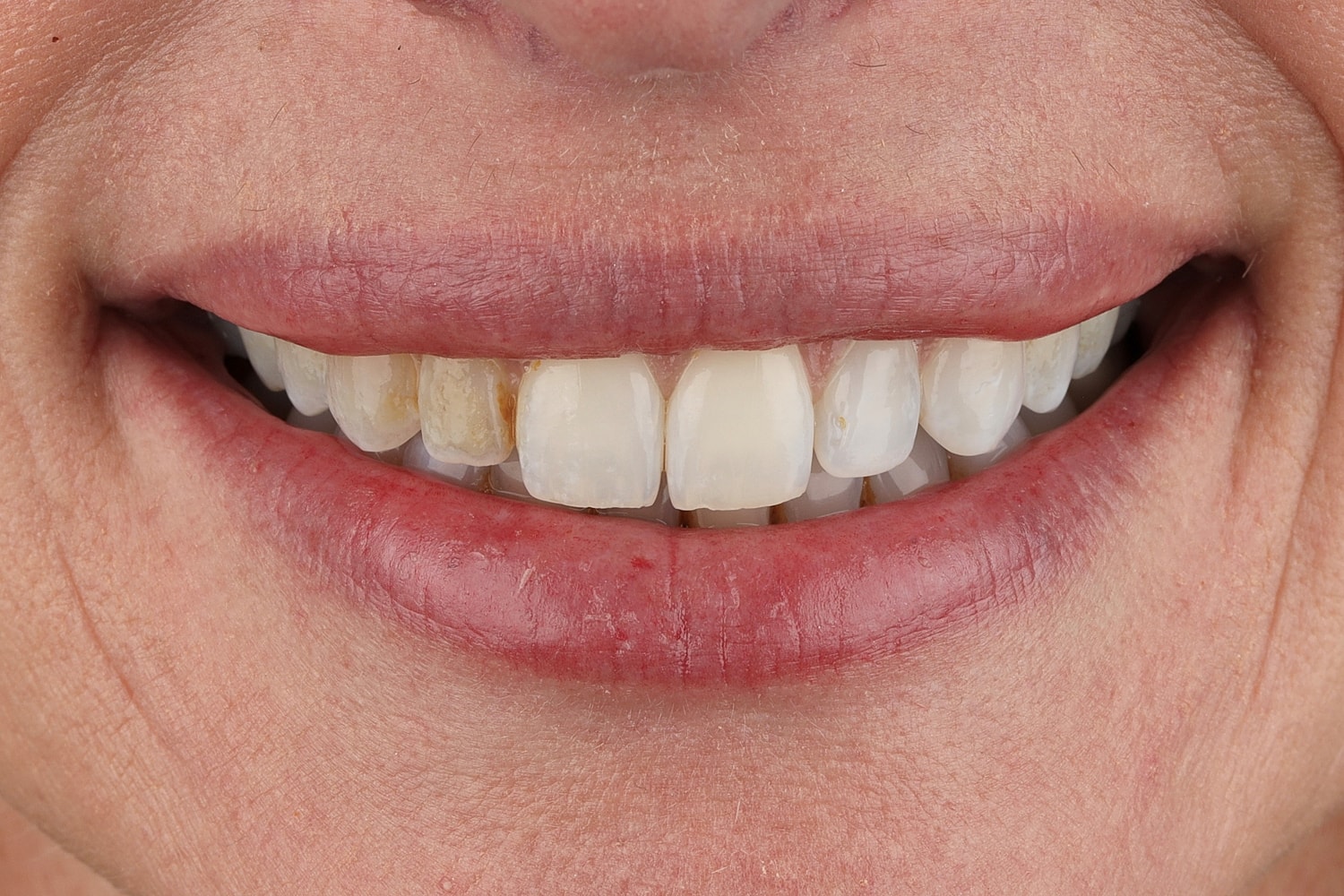 Close-up of a smiling mouth with teeth.