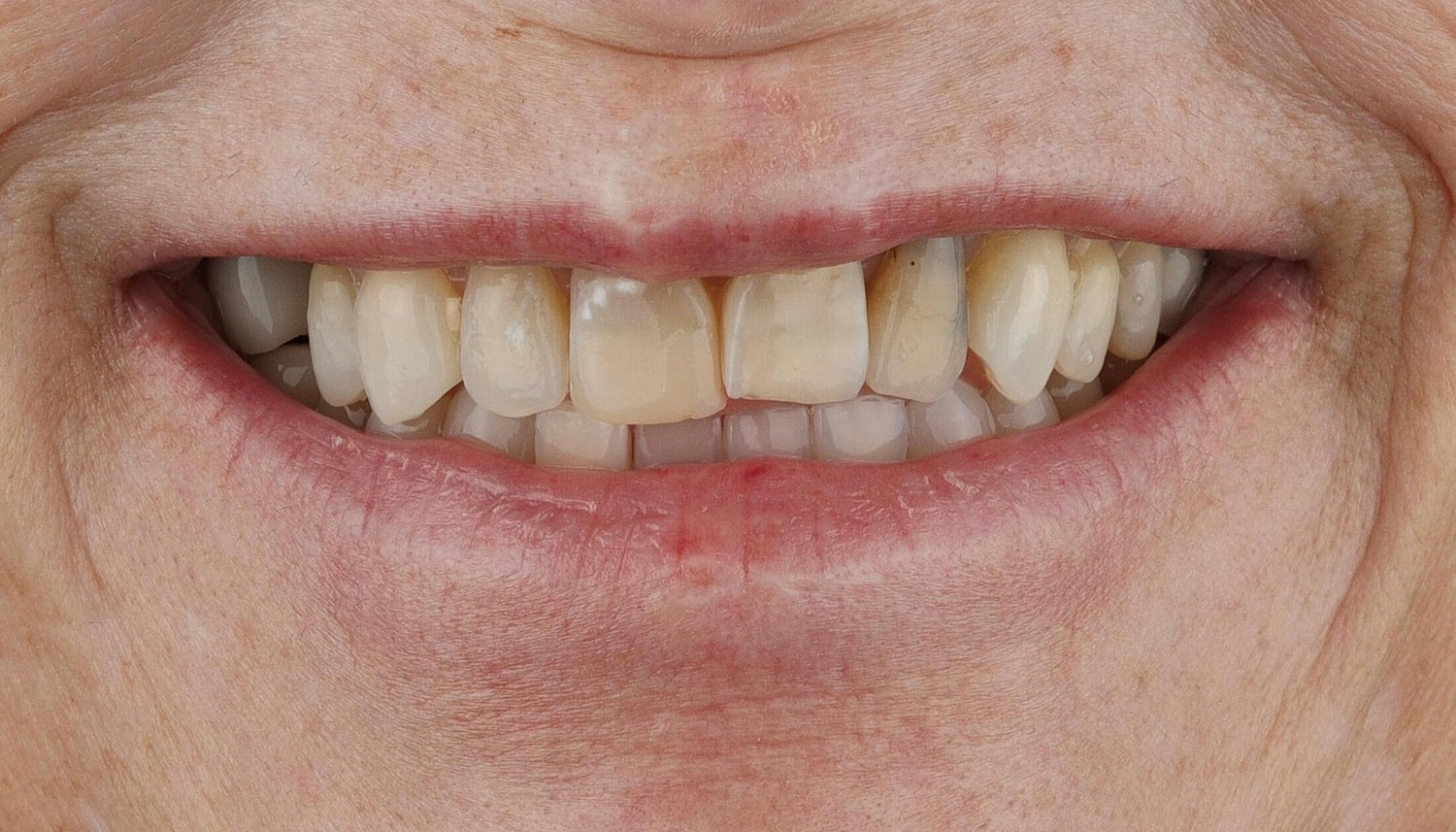 Patients Before & After