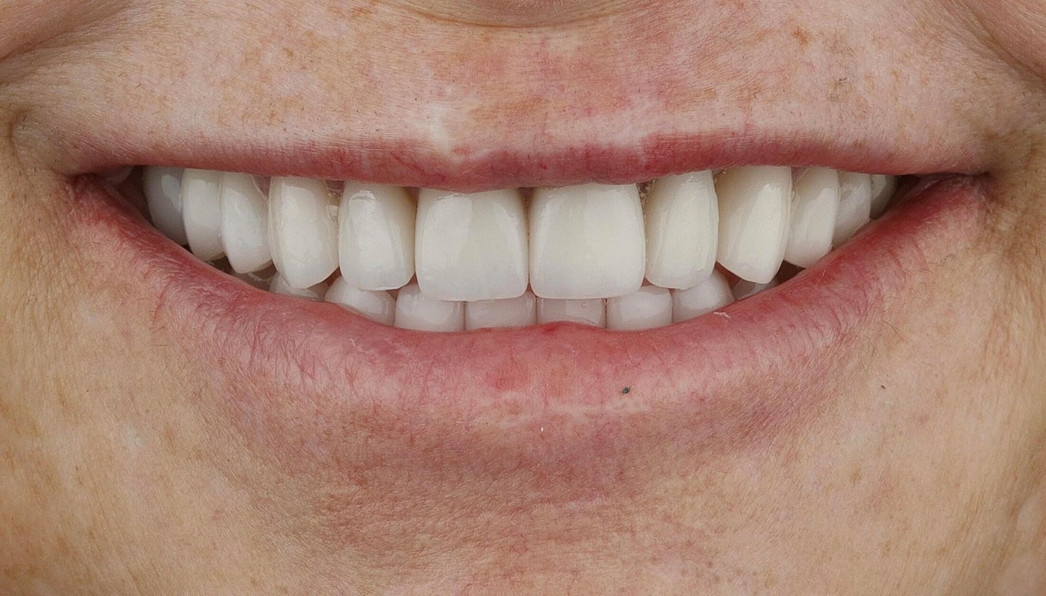 Patients Before & After