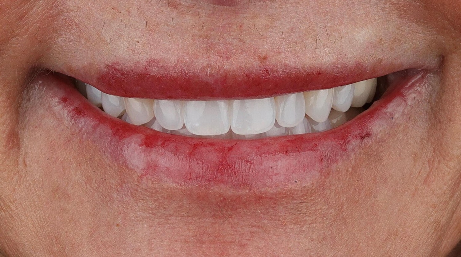 Patients Before & After