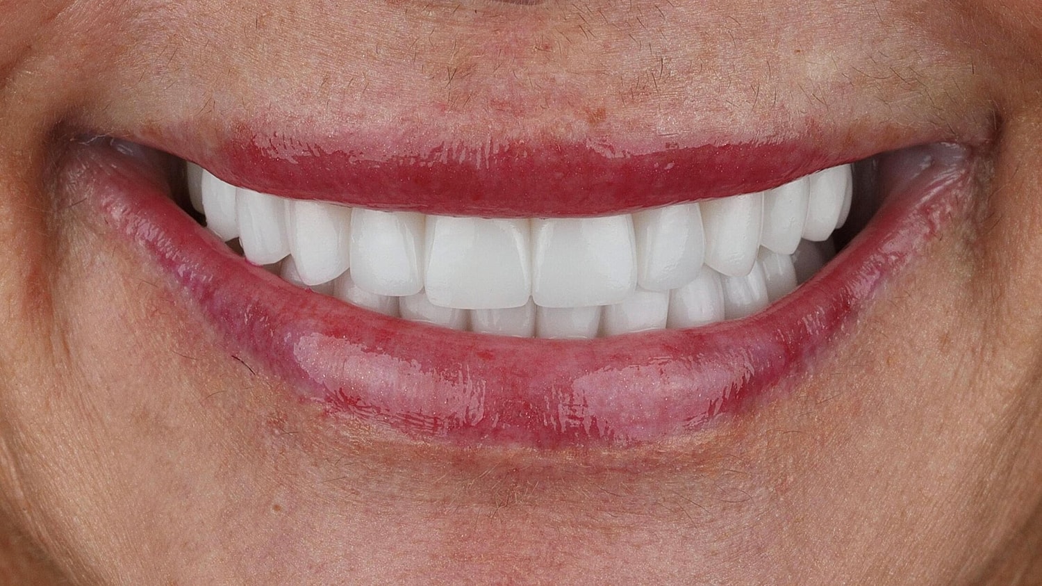 Patients Before & After
