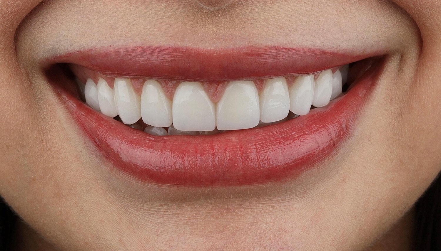 Patients Before & After
