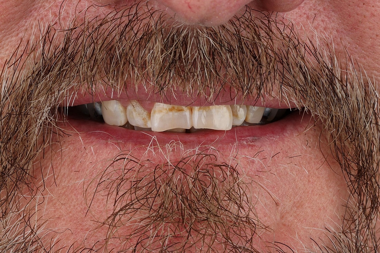 Patients Before & After