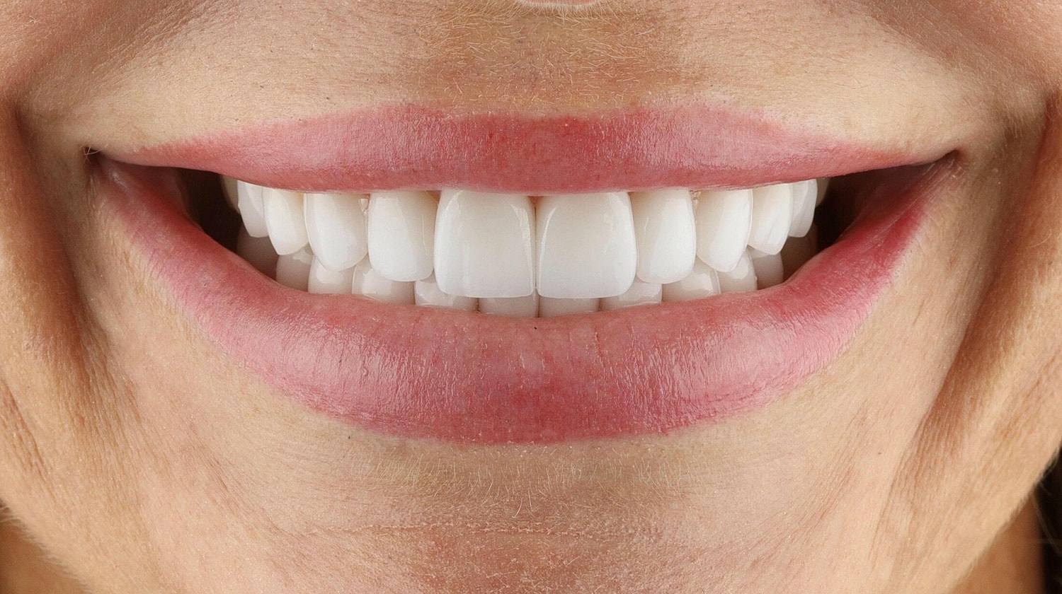 Patients Before & After