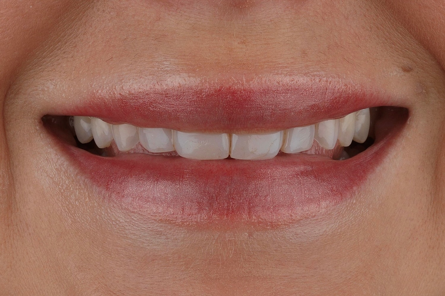 Patients Before & After