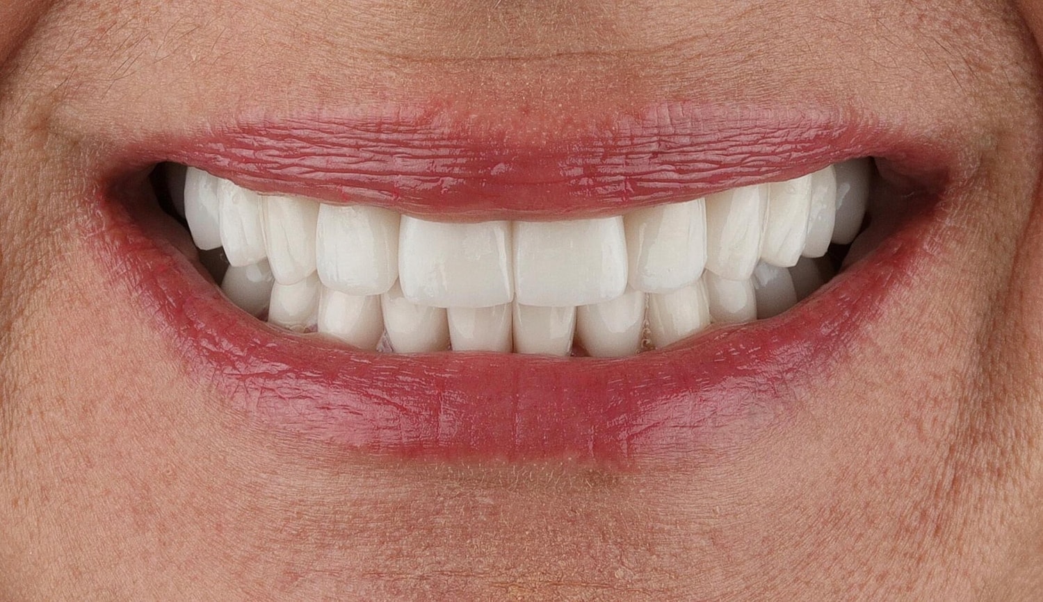 Patients Before & After