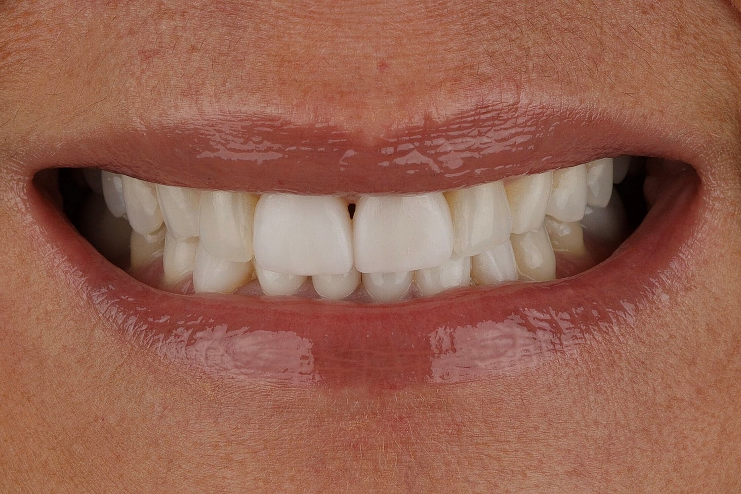Patients Before & After