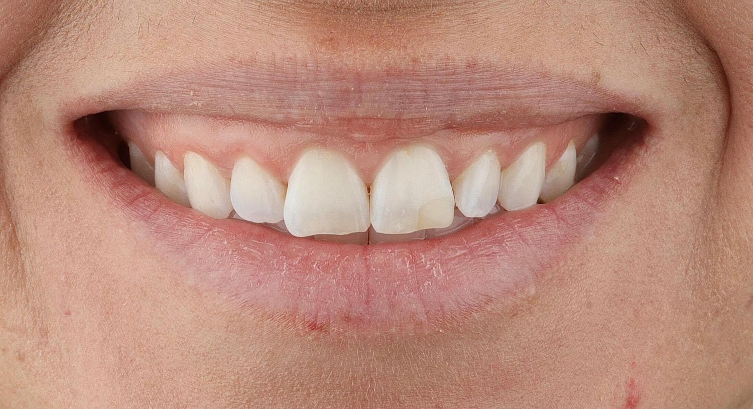Patients Before & After