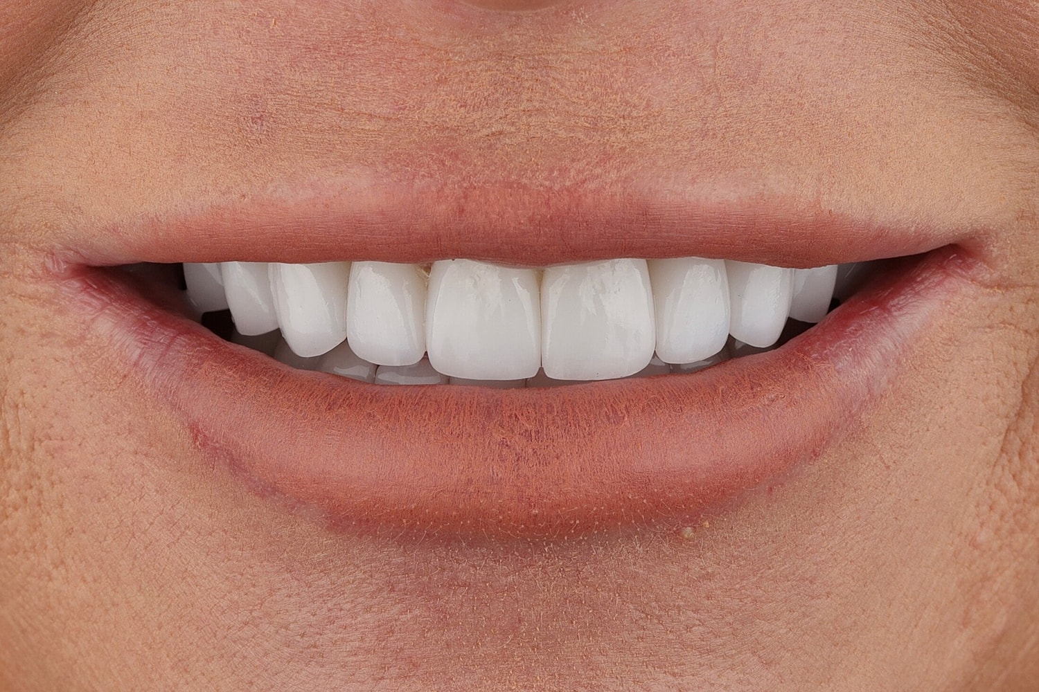 Patients Before & After