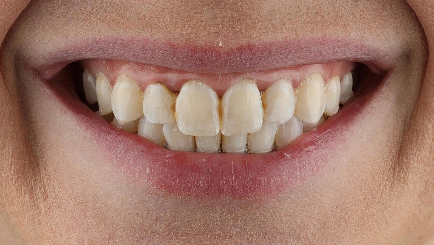 Patients Before & After