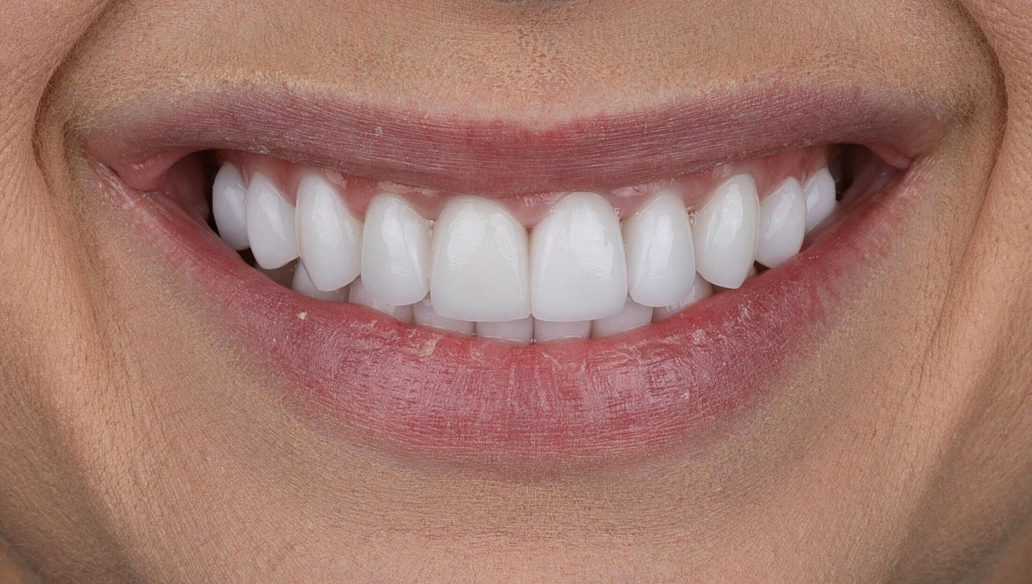 Patients Before & After