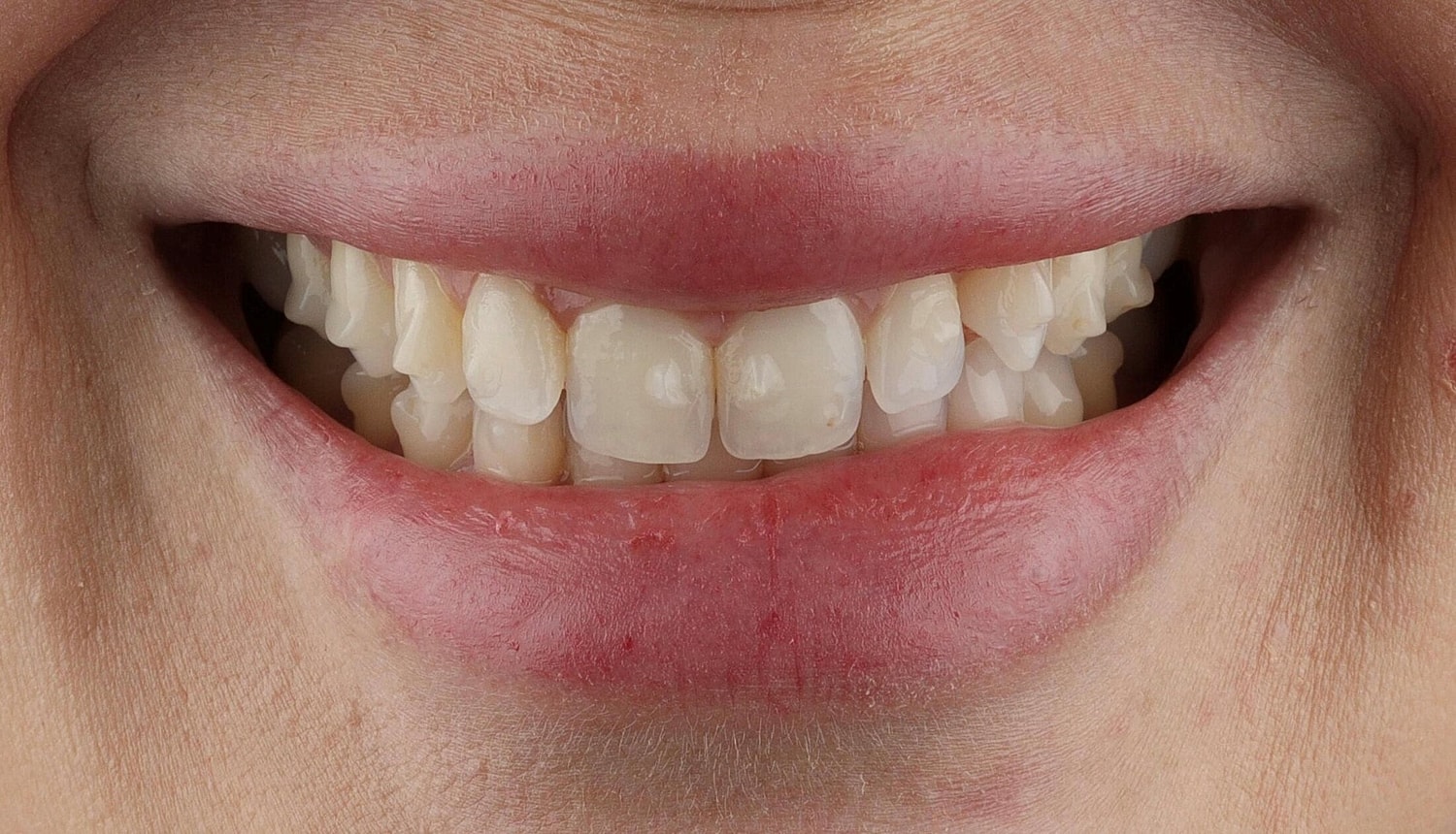 Patients Before & After
