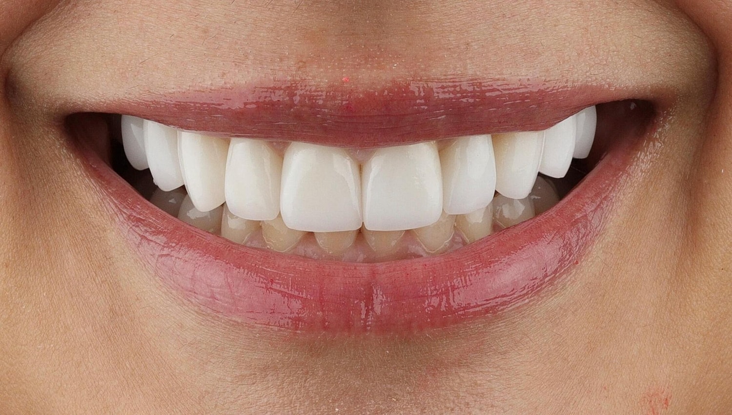 Patients Before & After