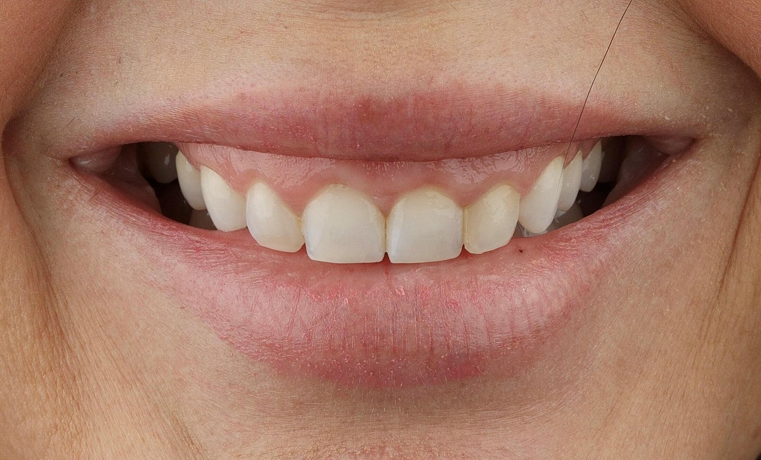 Patients Before & After