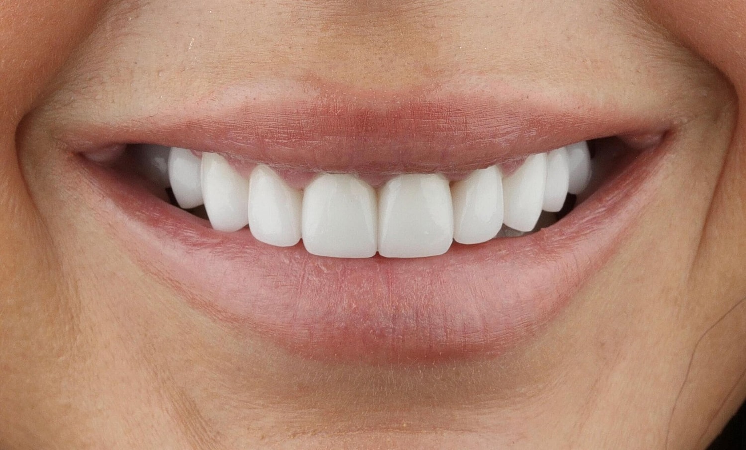 Patients Before & After