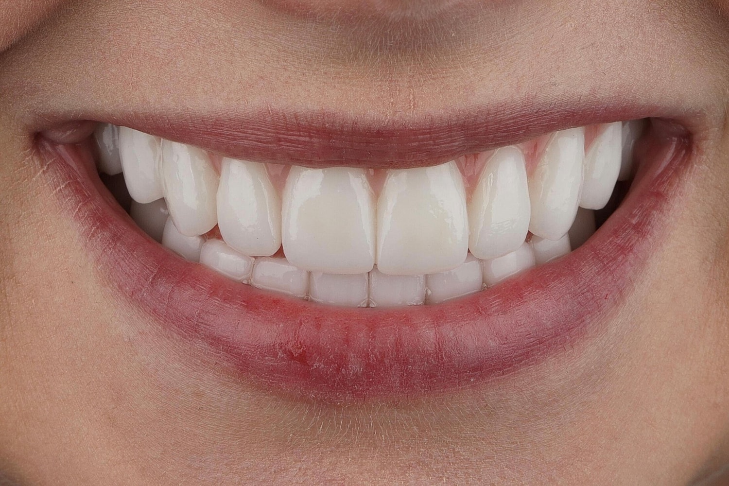 Patients Before & After