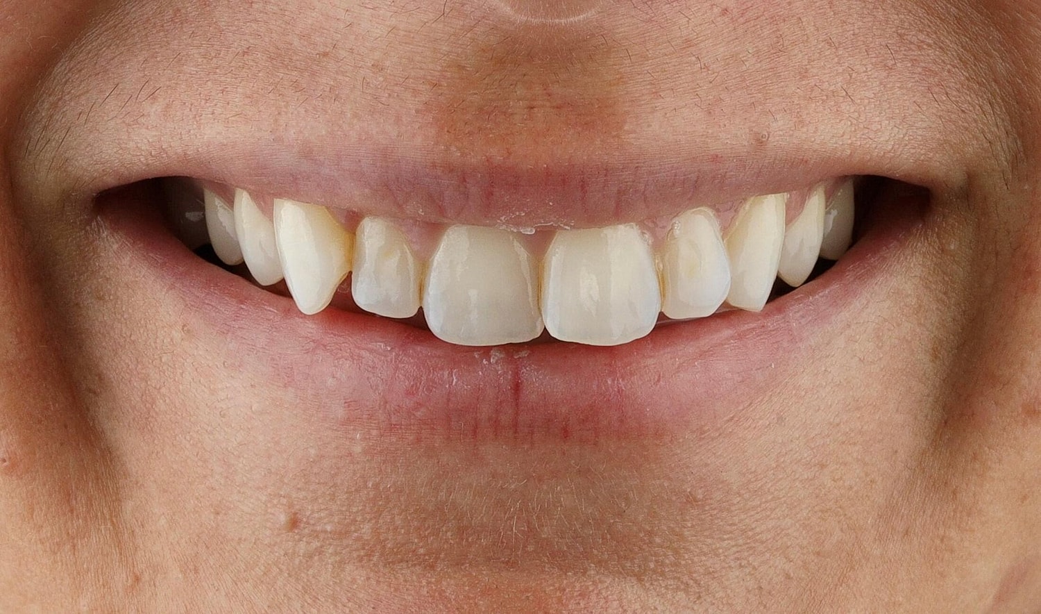Patients Before & After