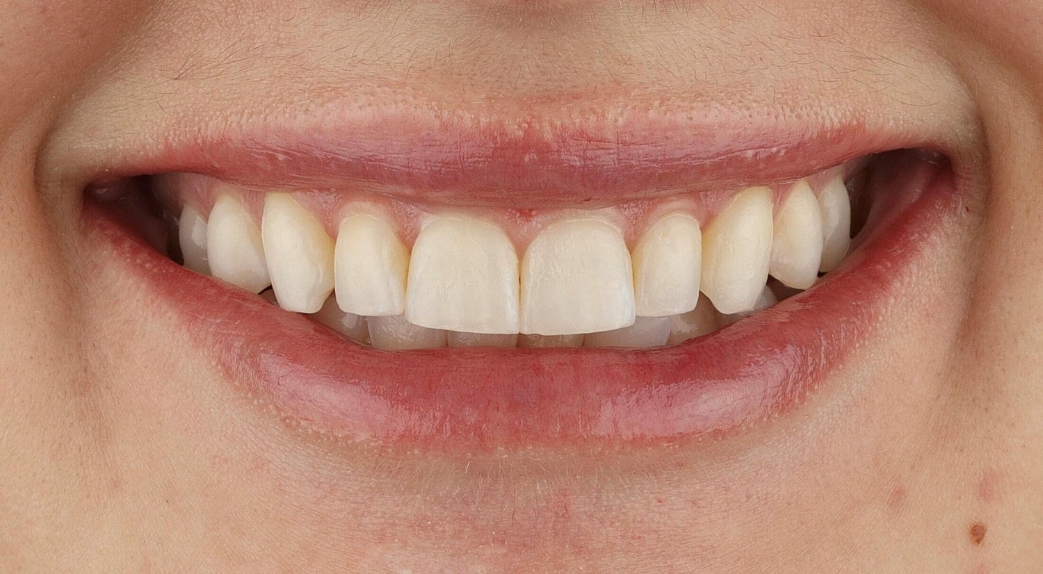 Patients Before & After