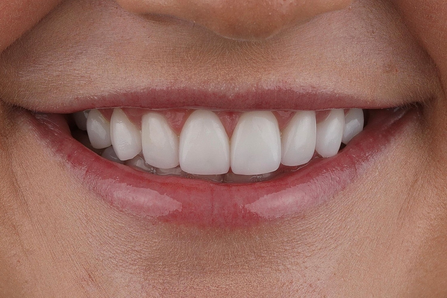 Patients Before & After