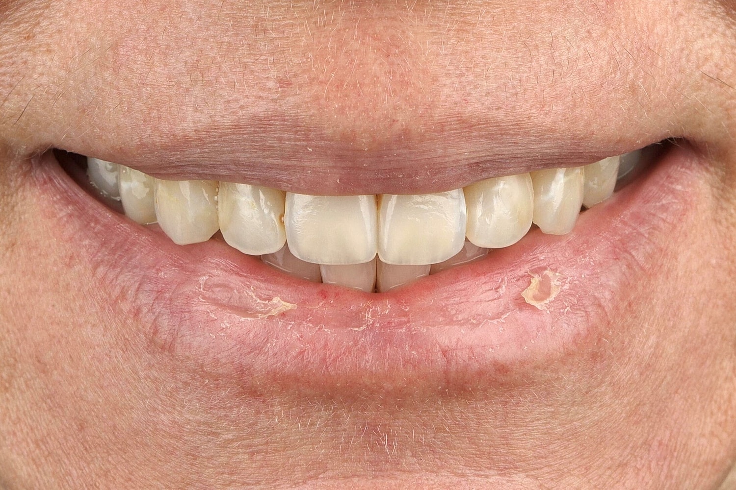 Patients Before & After