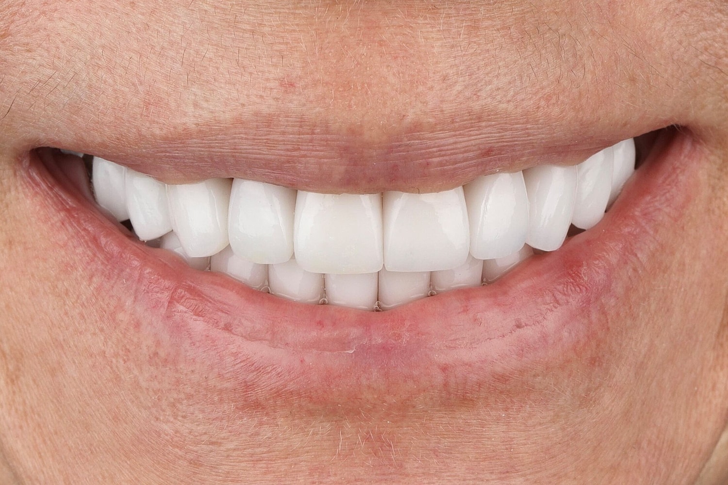 Patients Before & After
