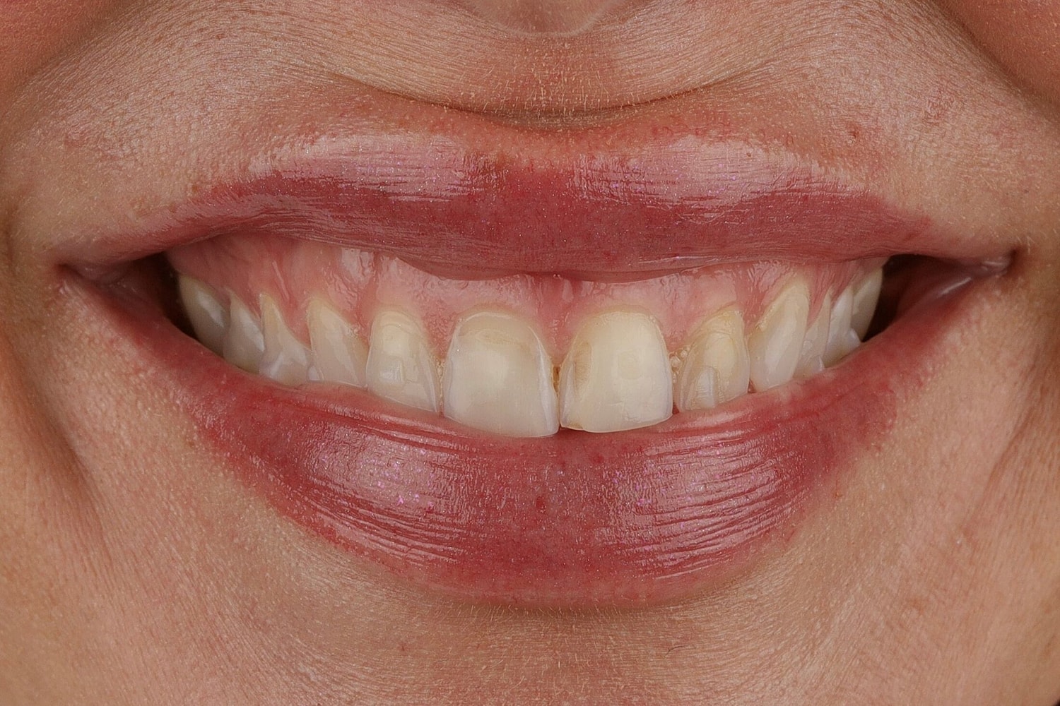 Patients Before & After