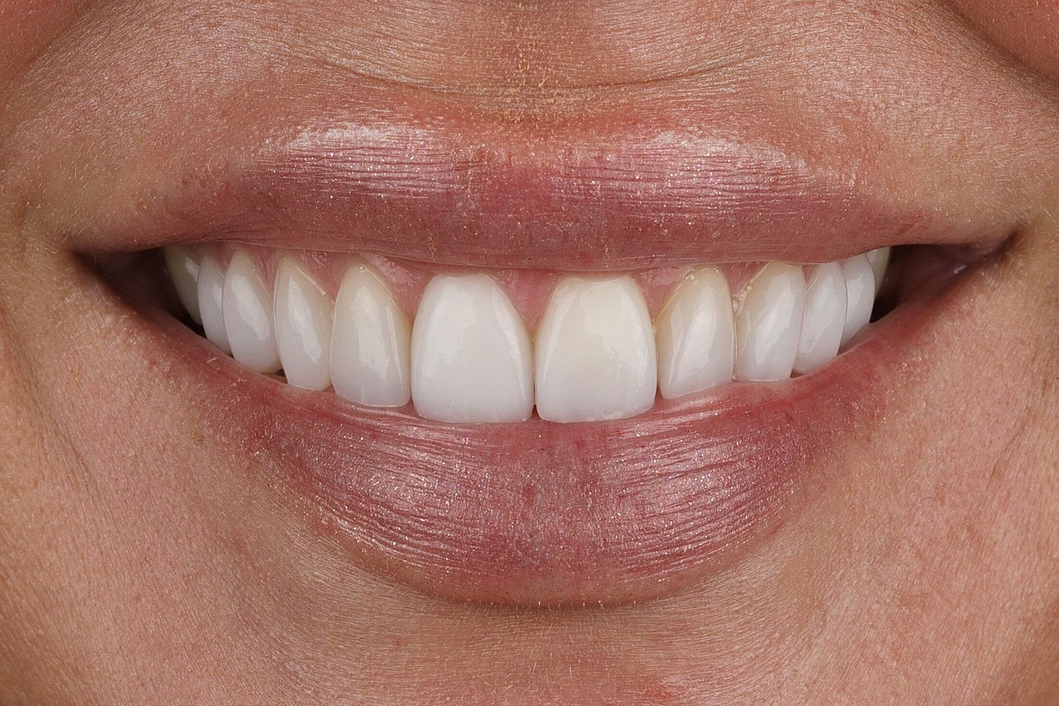 Patients Before & After