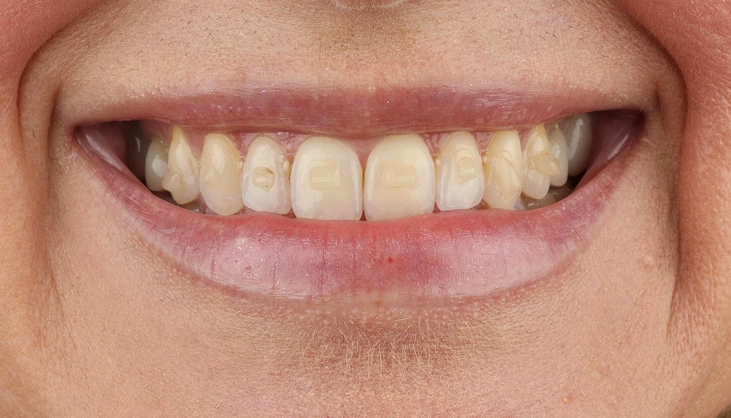 Patients Before & After